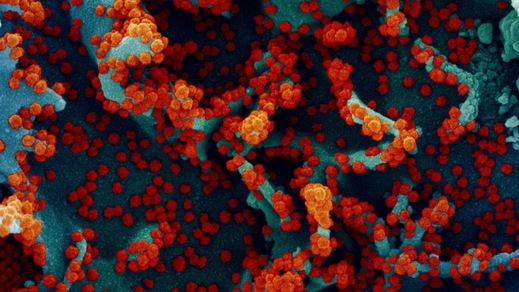 Coronavirus, preoccupano le varianti: quella del Regno Unito la più mortale