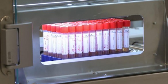 Coronavirus, il bollettino: 907 nuovi contagi, 36 i decessi