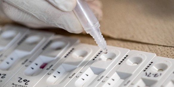 Coronavirus, i dati in Italia: 5.321 positivi e 5 morti