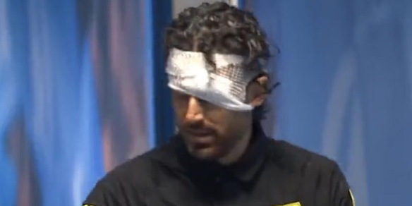 La lezione di Grosso ai criminali che potevano fargli perdere un occhio