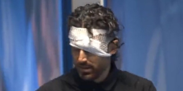 Aggressione a Grosso e alla squadra, Lione scioccato: “Non finisce qui”