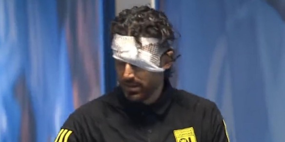 Aggressione Grosso, arriva la confessione shock: "Ero preso dall'euforia"