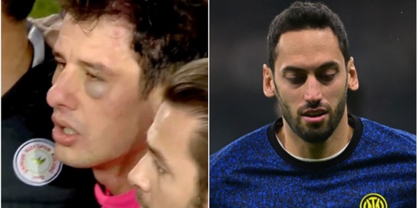 Calhanoglu sotto shock per l'aggressione all'arbitro turco: il messaggio sui social fa discutere
