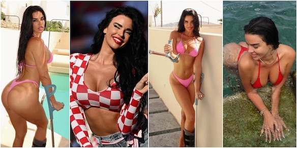 Ivana Knoll si infortuna a Mykonos: "Perone rotto ma sempre sexy"