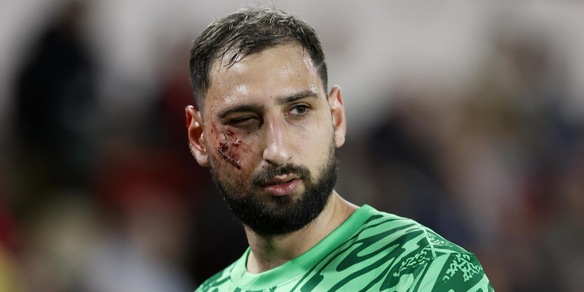 Donnarumma, la prima diagnosi dopo il brutale calcio in faccia