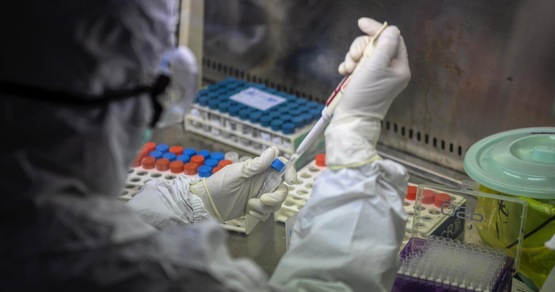 Covid, scoperto in Cina un altro Coronavirus: scatta l'allarme su una nuova pandemia