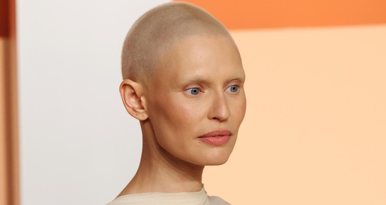 Bianca Balti e il tumore: "I capelli stanno ricrescendo, ora inizio una nuova terapia"