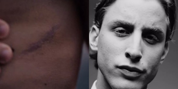 Bove, che emozione: in un video mostra per la prima volta la cicatrice sul petto