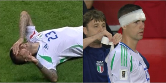 Mancini perde sangue dal sopracciglio, torna in campo bendato: la fotosequenza