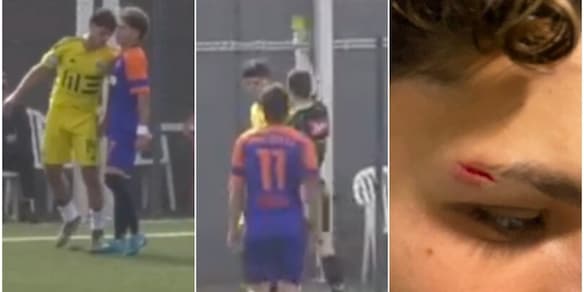 Testata a un giovane del Roma City sotto gli occhi dell'arbitro, ma niente espulsione