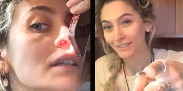 La figlia di Michael Jackson mostra il setto nasale perforato dalla droga: "La cocaina mi ha rovinato"