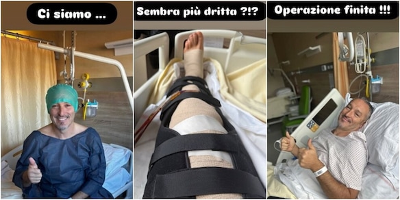 Zambrotta si opera, poi mostra la gamba sui social e scherza dopo l'intervento: "Sembra più dritta?"