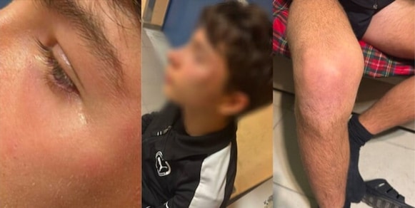 Follia in Puglia, arbitro di 15 anni aggredito. L'AIA furiosa: "Nuovo scempio, serve provare vergogna!"