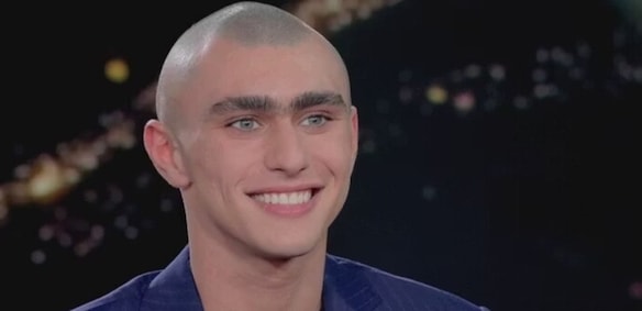 Il monociglio di Achille Costacurta fa discutere: "Lo toglierò ad una sola condizione"