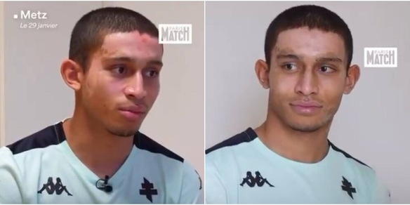 Crans-Montana, Tahirys Dos Santos è uscito dalla terapia intensiva: il drammatico racconto dell'incendio di Capodanno