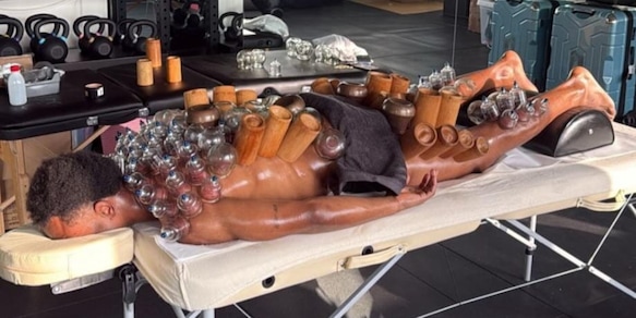 Openda e la foto shock sui social: perché l'attaccante della Juve è ricoperto da ventose