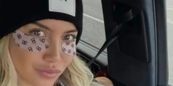Wanda Nara ha svelato il suo segreto di bellezza: i cerotti alla caffeina
