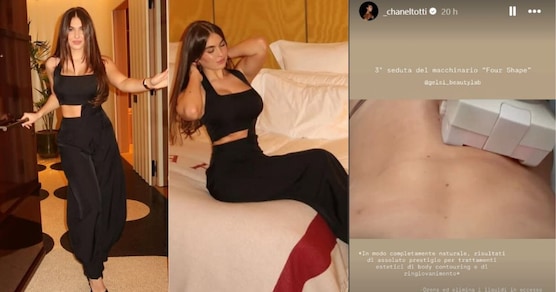 Come Chanel Totti rimodella il girovita senza interventi: il body contouring