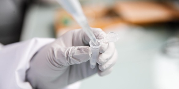 Individuato il motore che rende aggressivi i tumori, ora si possono fermare prima