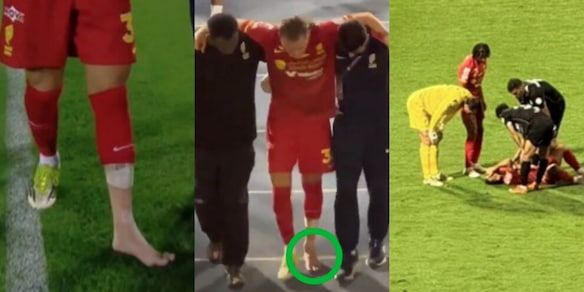 Retegui lascia il campo zoppicando: le immagini dall'Arabia, confermata la frattura della tibia