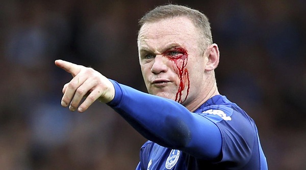 Rooney, infortunio choc al sopracciglio per una gomitata