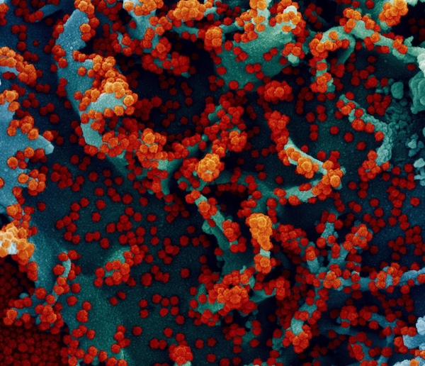 Coronavirus, preoccupano le varianti: quella del Regno Unito la più mortale