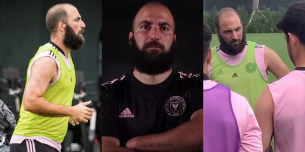 Gonzalo Higuain da non crederci: guardate com'è diventato