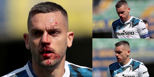 Verona-Atalanta, Toloi una maschera di sangue