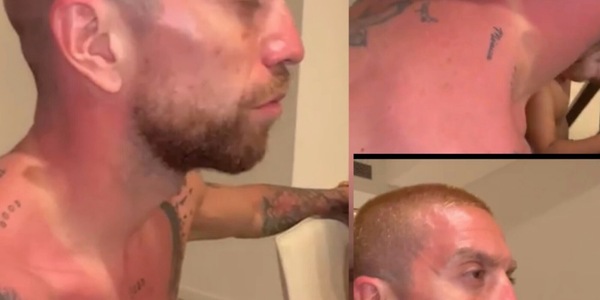 Argentina, Papu Gomez e le conseguenze fisiche dei festeggiamenti: il corpo è segnato!