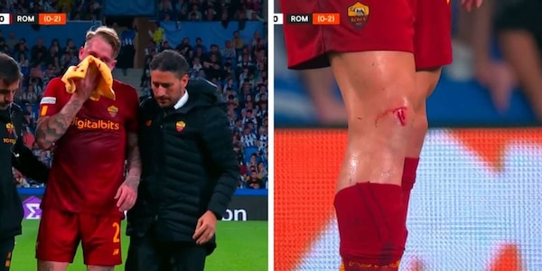Follia Real Sociedad: dopo Pellegrini, altri due romanisti feriti e sanguinanti FOTO