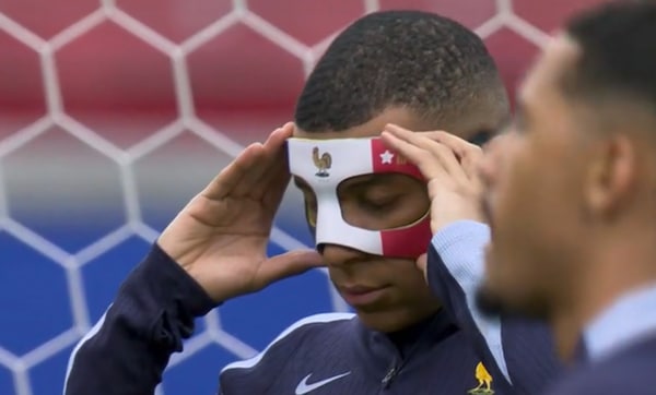Mbappé indossa la maschera dopo la rottura del naso: le foto sono virali