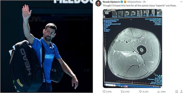 Djokovic mette le prove sui social, il gesto contro i critici: “Per gli esperti di infortuni”
