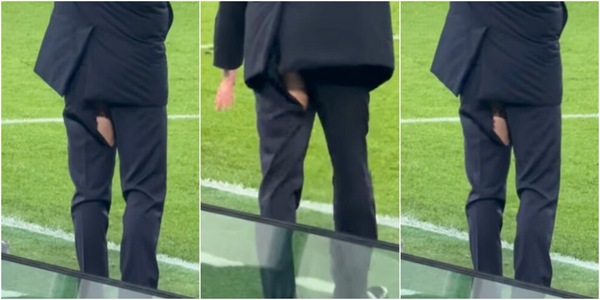 Inzaghi con i pantaloni rotti contro la Juve: le immagini virali sui social