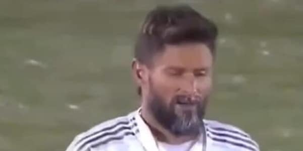 Giroud da brividi: barba ghiacciata in campo per il francese