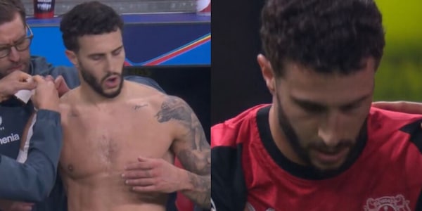 Roma, Hermoso ko in Bayer Leverkusen-Bayern Monaco: esce infortunato