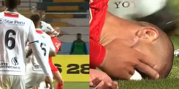 Clamoroso in Sudamerica: mascella fratturata e tre denti caduti, per l'arbitro è solo giallo