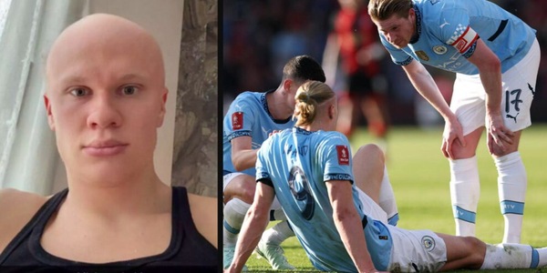 Haaland "cambia" look: la foto senza capelli disorienta i social