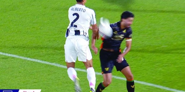 Moviola Venezia-Juve: Colombo bene su Alberto Costa. Netto il rigore per i bianconeri