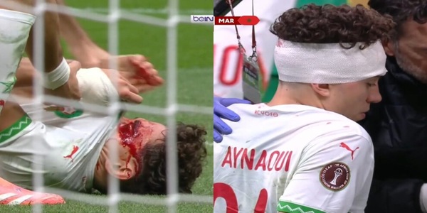 El Aynaoui, brutto scontro con Diouf: sangue e bendaggio in testa