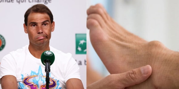 Nadal, le immagini del piede infortunato sono impressionanti: "Mi dicevano che avrei dovuto smettere di giocare"