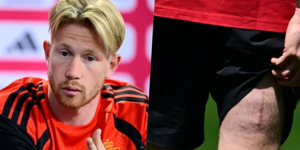 Tutte le verità di De Bruyne: il Napoli, Lukaku, il futuro e quella cicatrice...