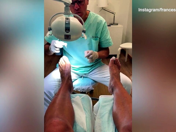 Totti si fa "bello" con la pedicure
