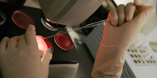Scambio di provetta, impiantato l'embrione sbagliato al San Raffaele di Milano