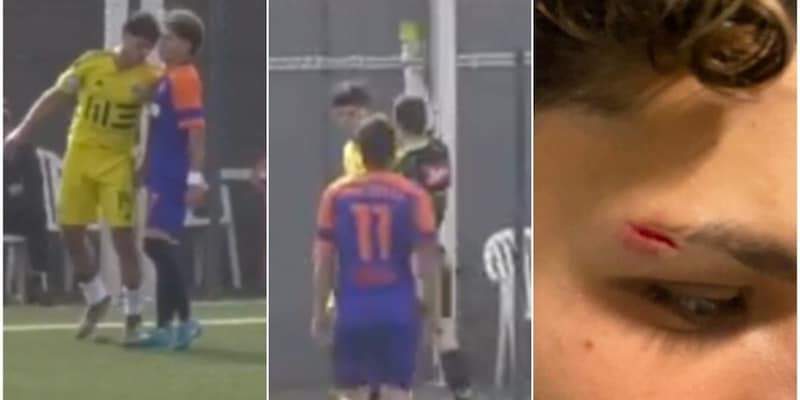 Testata a un giovane del Roma City sotto gli occhi dell&#39;arbitro, ma niente espulsione