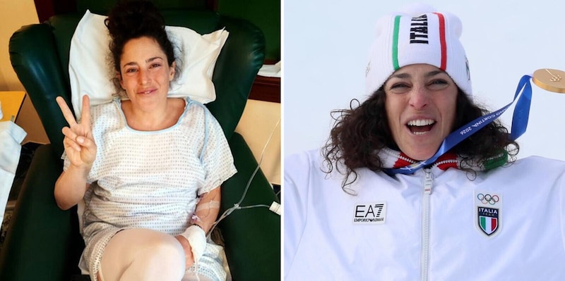 Brignone, 315 giorni dall'infortunio all'oro. Tutte le tappe del calvario e il racconto incredibile di Panzeri: "Quando ho visto quella frattura..."