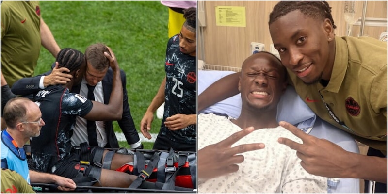 Kon&eacute; operato per la frattura alla gamba: diagnosi e tempi di recupero