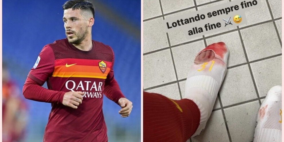 Carles Perez Foto Impressionante Il Piede E Insanguinato